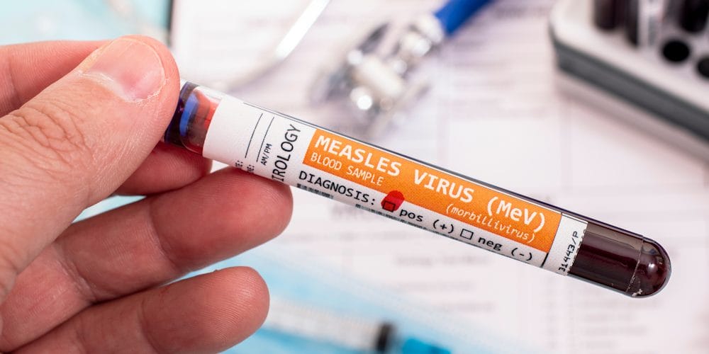 Measles Vaccine For Children In Colorado